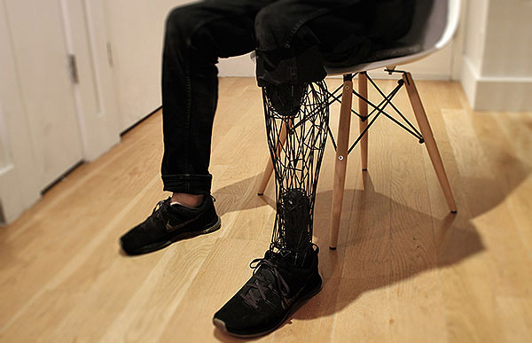 2.Exo Prosthetic Leg, la prótesis impresa en 3D de William Root